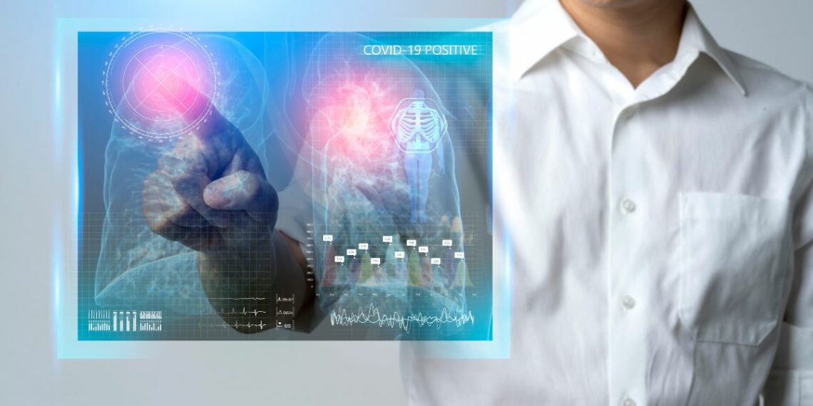 1200 Asian Reseacher Check Lung Chest Covid19 Patient Xray Report With Positive Result Infection Detech Corona Virus Outbreak Epidemic Analysis Effect From Covid Human Body Test Concept