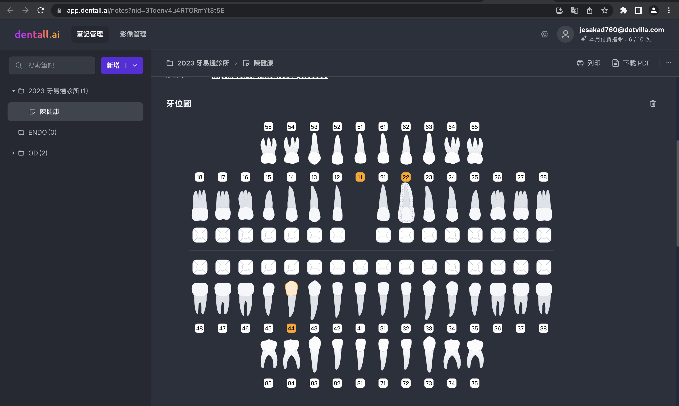 新聞照片03_ 透過 dentall.ai 彈指間就將病歷文字或語音，轉化為精美又直觀的牙位圖